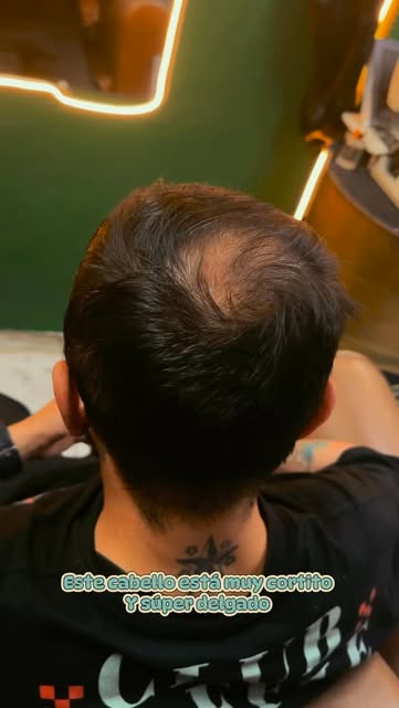 Valoración del cabello antes de la instalación
